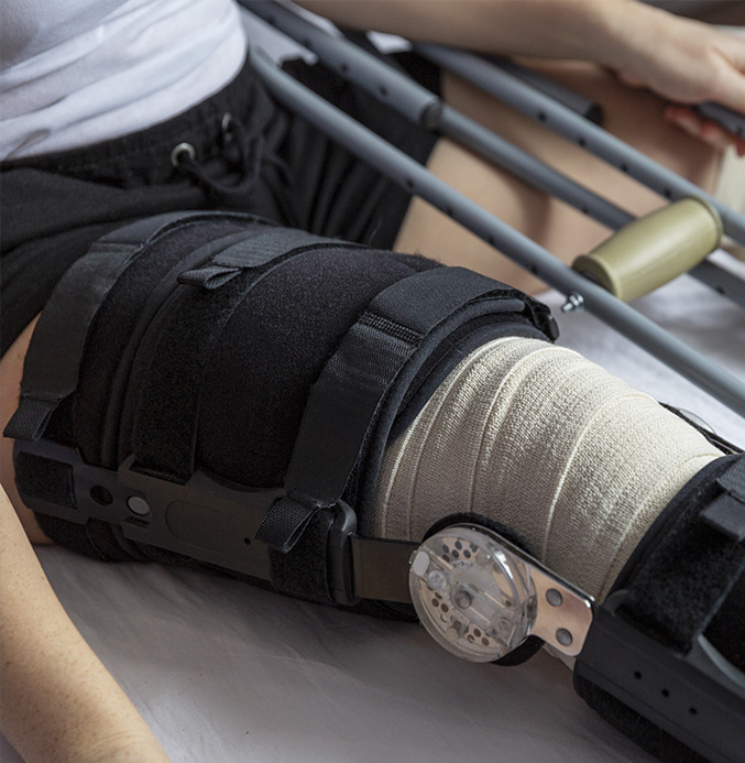 Picture of knee bandaged in a splint.
